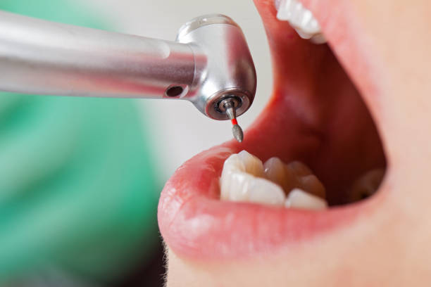 Best Pediatric Emergency Dentist in Ofallon, IL